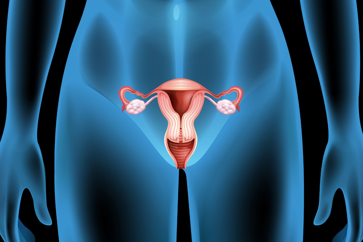 Illustrative Darstellung, Röntgen der weiblichen Geschlechtsorgane